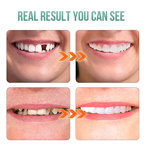 Лажни заби, 2 парчиња заби на фурнири за жени и мажи, стоматолошки фурнири за привремена поправка на забите горната и долната вилица, да ги заштитат