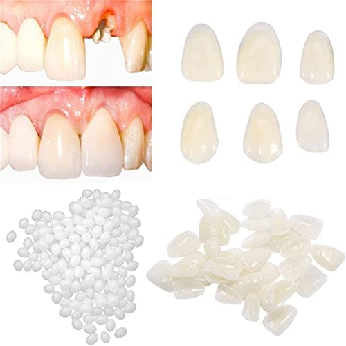 Замена на забите на дното привремен комплет за заби за пополнување на испуканите скршени заб и празнини што може да се обликуваат привремени