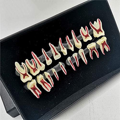 Демонстрациски модел на листопадни заби - модел на пулпа на листопадни заби - модел на настава за заби Дентолошки орален модел - Стандардна алатка за демонстрација,